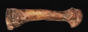 Metatarso piede Afarensis